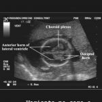 ecografie monitorizare sarcina obstetrica ginecolog bucuresti doctor diana mihai